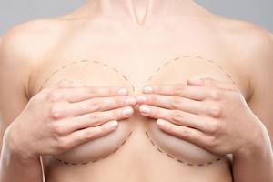 Аугментационная маммопластика - удаление грудных имплантов