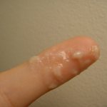 белые выделения