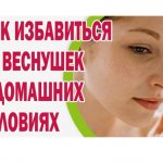 Как избавиться от веснушек и пигментных пятен?