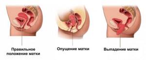 Особенности строения женских органов после родов