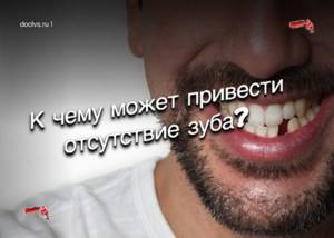 отсутствие зуба
