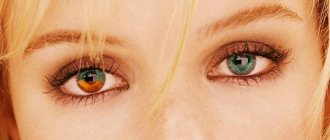 Разноцветные глаза у человека