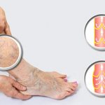 Жжет вена на ноге фото 1